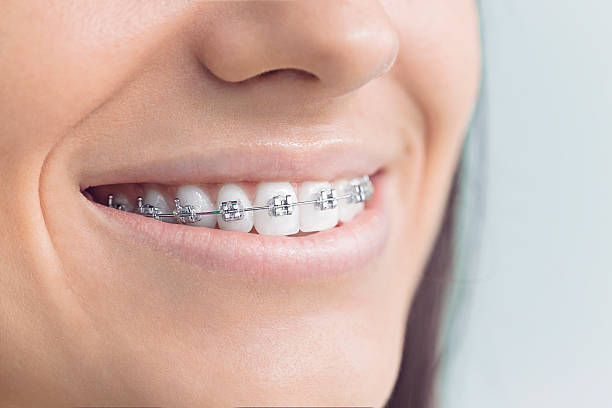 Best Invisalign and Clear Aligners  in Byesville, OH